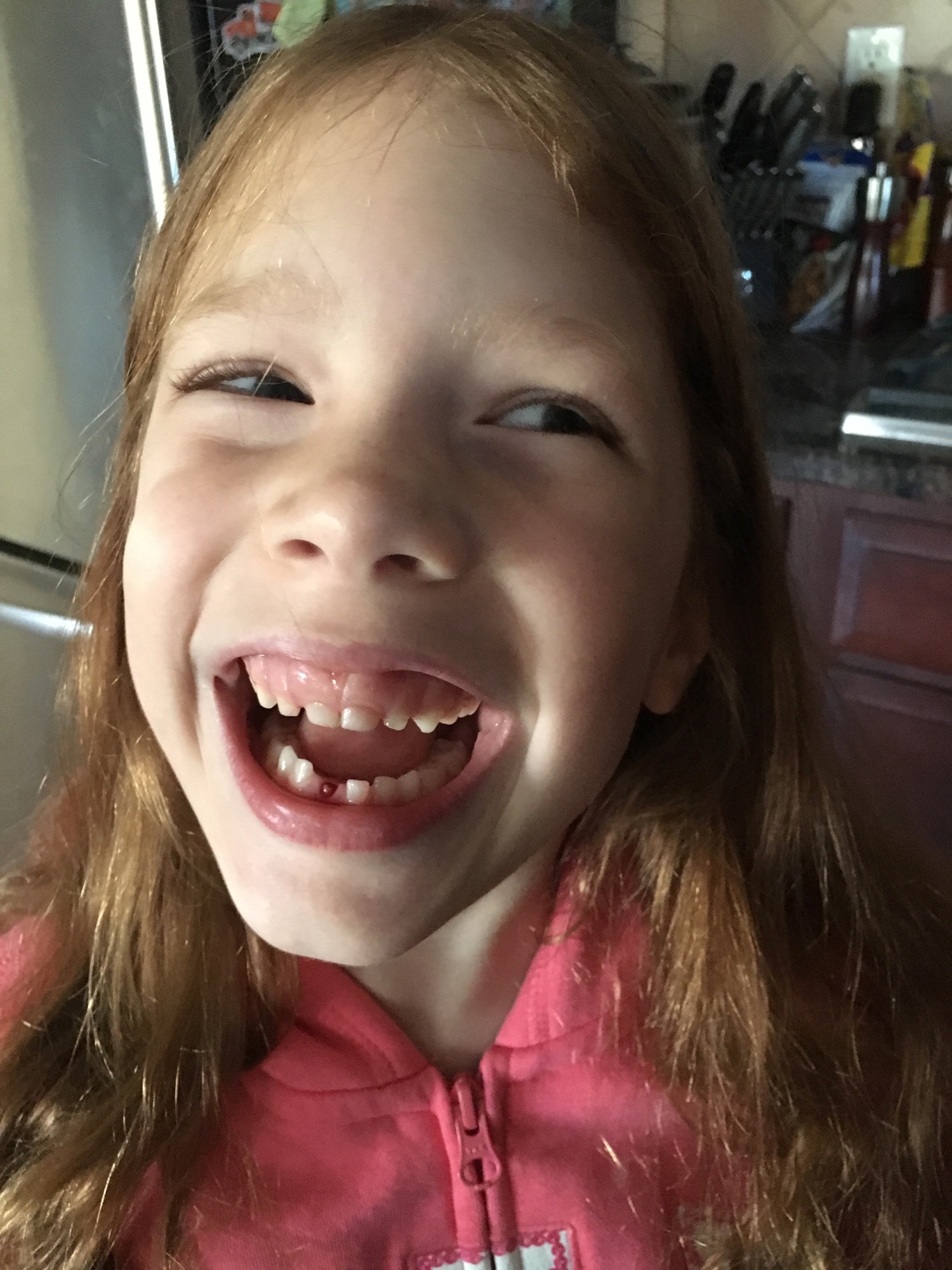 2015-11-20-tooth photo